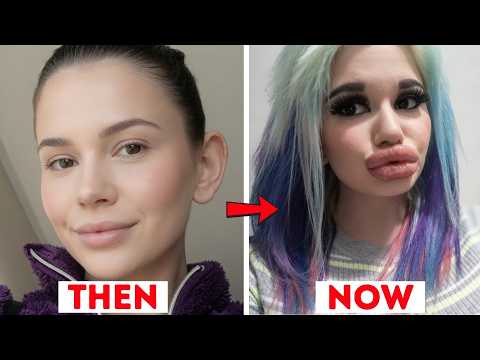 20 Famous Faces Changed by Plastic Surgery | Then and Now 2026