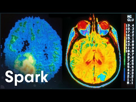 HOW DOES THE BRAIN ACTUALLY WORK?