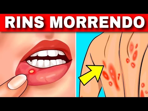 RINS em PERIGO! 9 SINAIS de que seus RINS estão MORRENDO + 5 DICAS para SALVÁ-LOS AGORA!