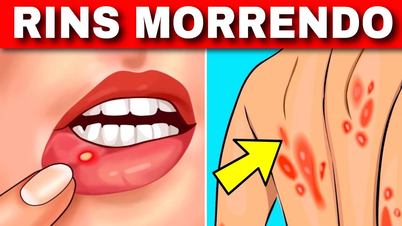 RINS em PERIGO! 9 SINAIS de que seus RINS estão MORRENDO + 5 DICAS para SALVÁ-LOS AGORA!