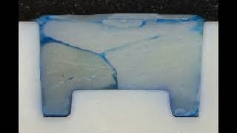 Knit Lines and Voids in Dental Fillings