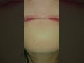 #lips #beauty