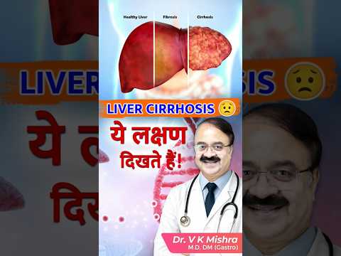 Liver Cirrhosis के लक्षण 😟 | ये संकेत दिखें तो सावधान! | #Shorts