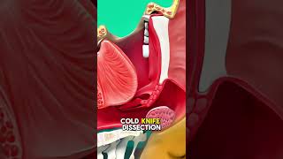 Tonsils And Adenoids Removal Surgery Medical Animation 3D