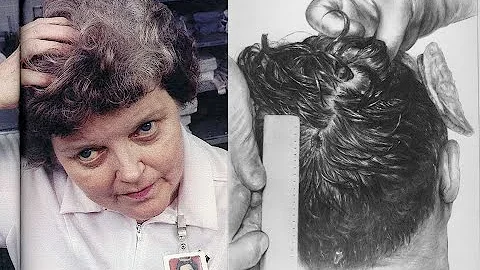 Nurse Doris Nelson's Reaction to JFK Autopsy Photo...