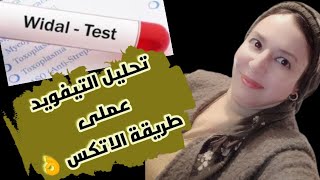 تحليل التيفويد(widal test) عملى بأسهل طريقة للمبتدئين 👍