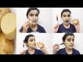 This Facial will Remove your Dark Spots & pigmentation | आलू से कैसे करें फेशियल