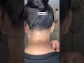Neck Darkness Before & After ✨ | Natural Home Remedy for Dark Neck | Try for 30 Days