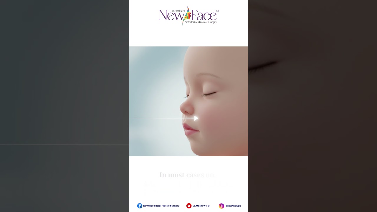 Will My Child Need Multiple Surgeries After Cleft Lip Surgery? | Expert Advice by Dr. Mathew PC