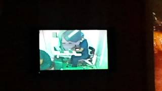 Download Lagu Live Robotic Assisted Surgery @ Centre For Robotic Surgery (CRS) - MPUH, Nadiad. MP3