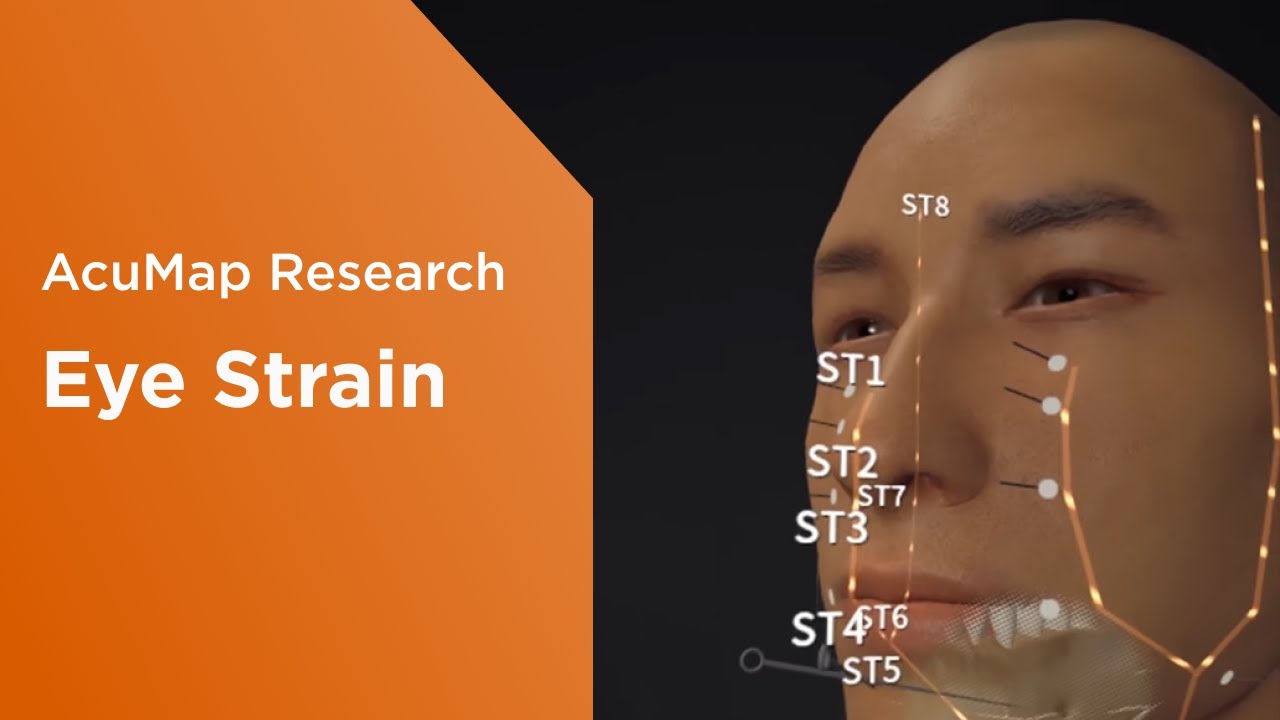AcuMap: Research Topic – Eye Strain