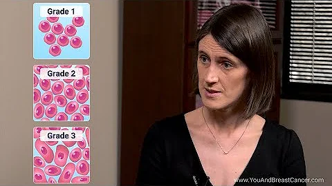What are the grades and stages of breast cancer? - DayDayNews