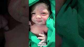 Birthblogcutebabycutebabybabyboybabygirlshorttrendingviral