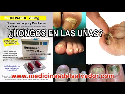 pastillas para los hongos de las uñas