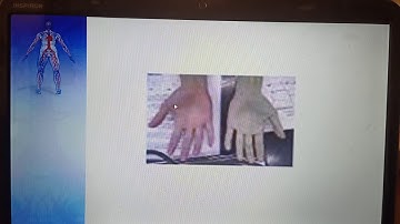 CVS Examination (Capillary Microcirculation) Power point Dr Mohamed Fayez