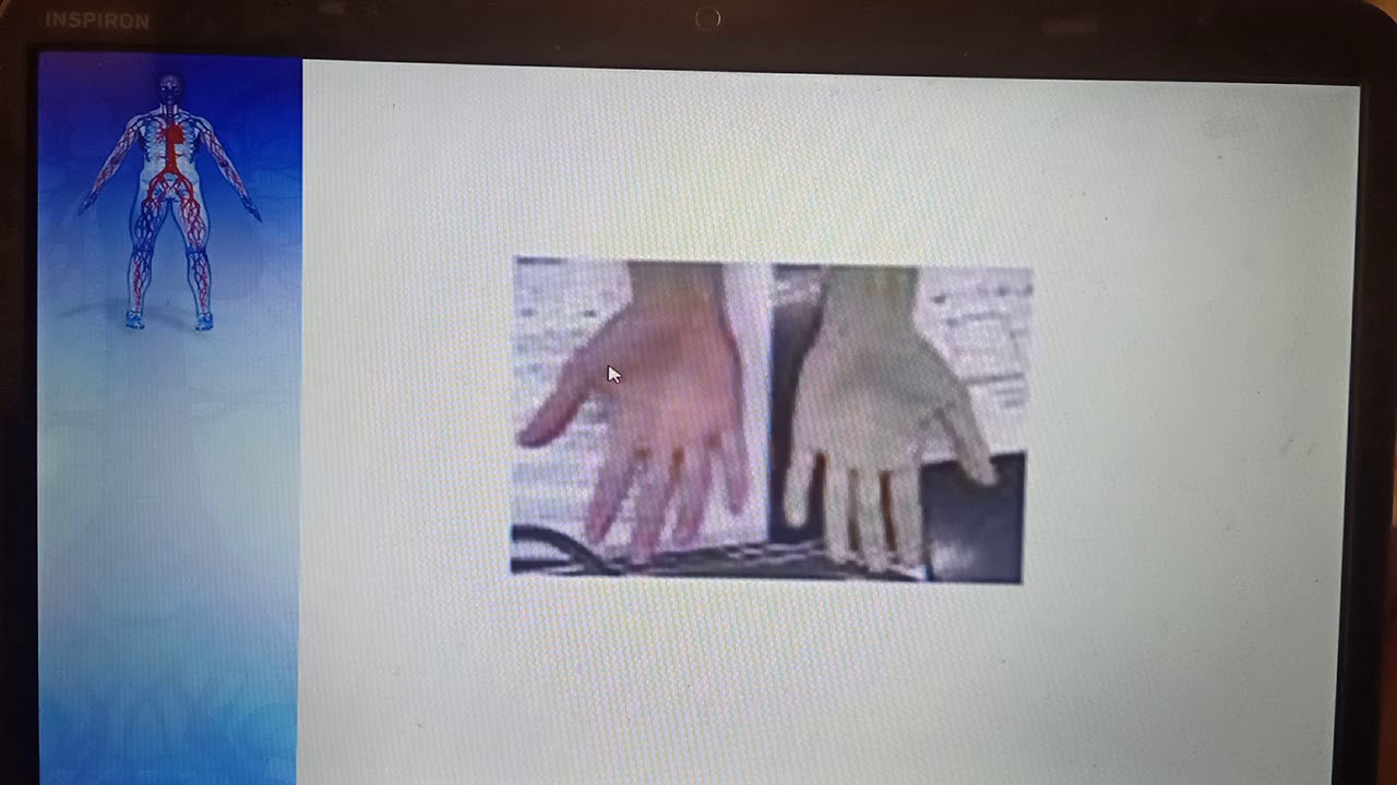 CVS Examination (Capillary Microcirculation) Power point Dr Mohamed Fayez