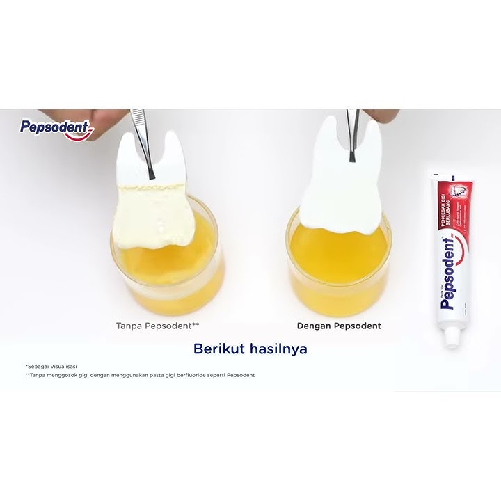 Pepsodent Pencegah Gigi Berlubang Pasta Gigi White 190G