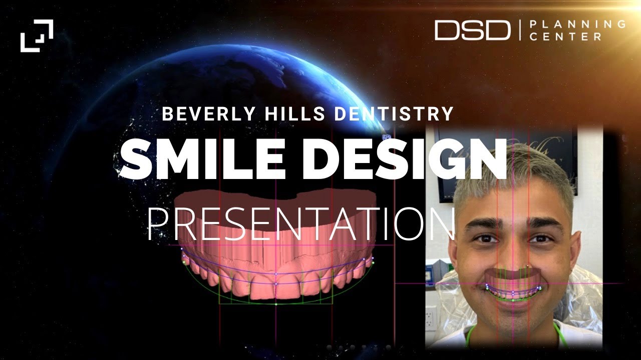 DESIGNING THE BEST SMILE MAKEOVER | Beverly Hills Dentistry