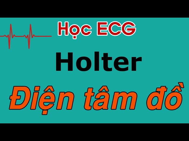 Holter điện tâm đồ - phân tích và cách làm như thế nào l ECG cơ bàn