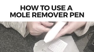 How to Use the Mole Remover Pen || Tutorial and Demo