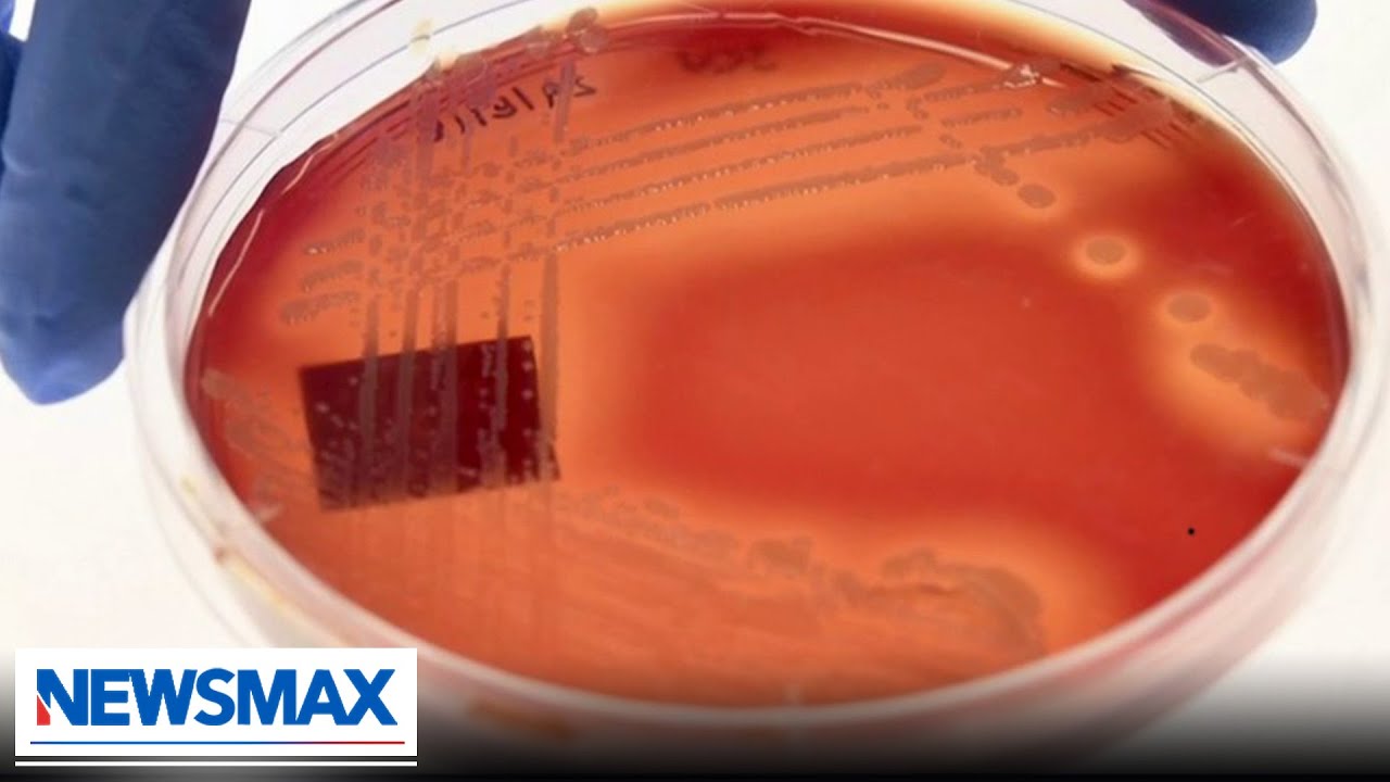 CDC Deadly fungus spreading at an alarming rate Wake Up America