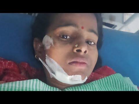 Accident Ho Gaya ilaaj chal raha hai aap like subscribe karke support Karen