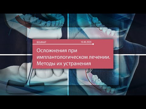 Осложнения при имплантологическом лечении. Методы их устранения