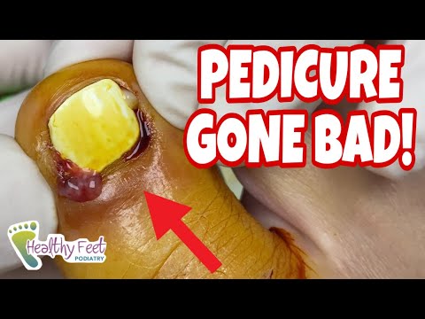 Video: A Pedicure That Ended Badly