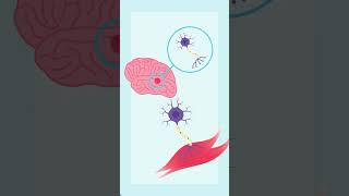 Human Disease Made Simple: ALS #shorts