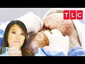 Dr lee treats the largest nasal growths shes ever seen  dr pimple popper  tlc