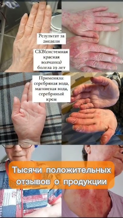 Турецкие бады - YouTube