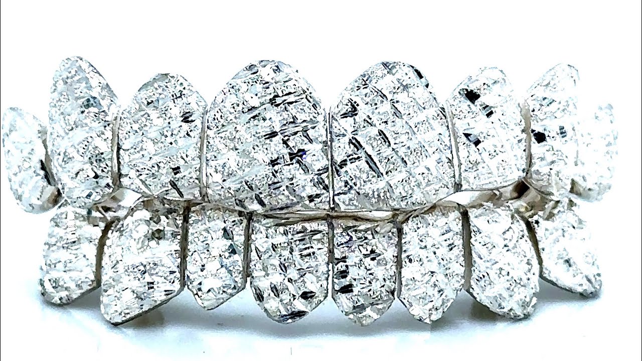 Diamond dust grillz are a #1 request at Seattle Gold Grills