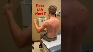 Does Allergy Skin Testing Hurt What to Expect.