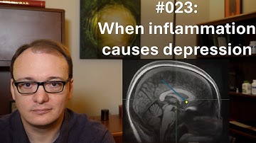 023 - Inflammation causes depression
