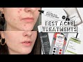 5 BEST ACNE SKINCARE TREATMENTS | Overnight Acne Treatments