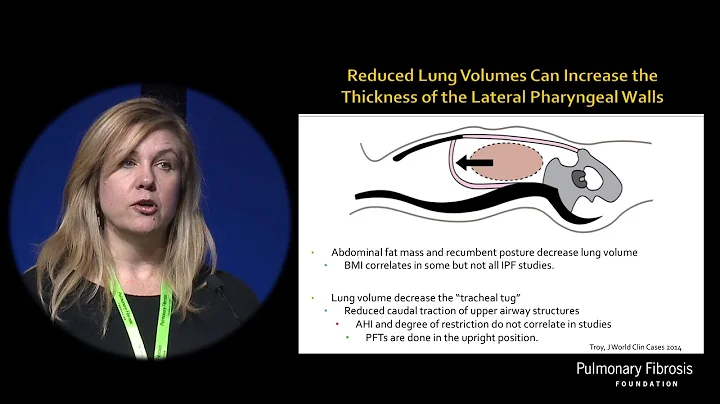 Sleep Apnea in ILD | Lisa Lancaster, MD