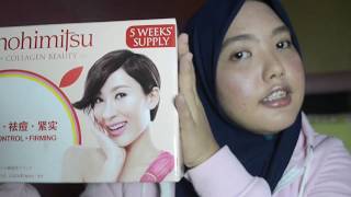 SUPPLEMENT WORTH IT OR NOT FOR ACNE SKIN??!! | KINOHIMITSU | MALAY