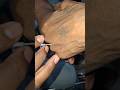 IV cannula technique video part 80 #hospital #video #shorts