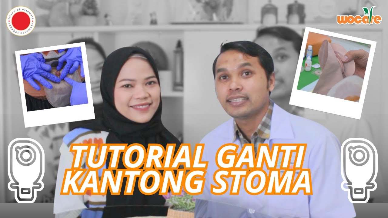 CARA GANTI KANTONG STOMA SENDIRI | BISIK OSTOMATE