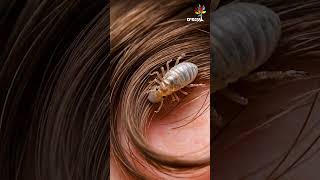 הכינה - היצור הקטן שחי על הראש! 😱 | עולם החיות בהמחשת AI מיוחדת