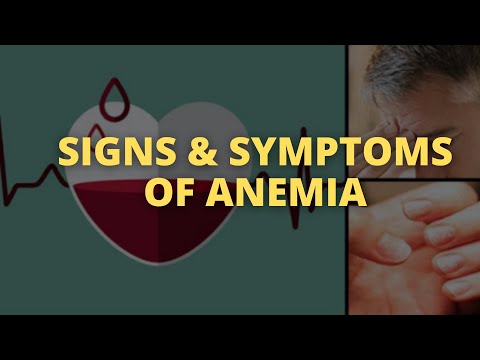 Signs and Symptoms of Iron Deficiency | ANEMIA