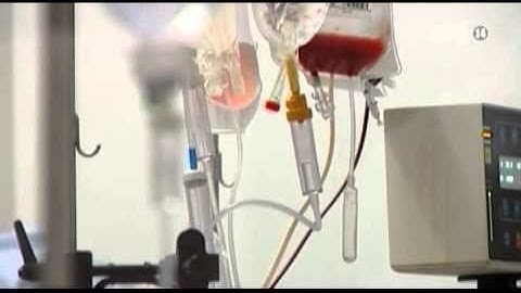 VTC14_Điều trị thành công ca ung thư vú bằng ghép tế bào gốc tạo máu đầu tiên tại Việt Nam