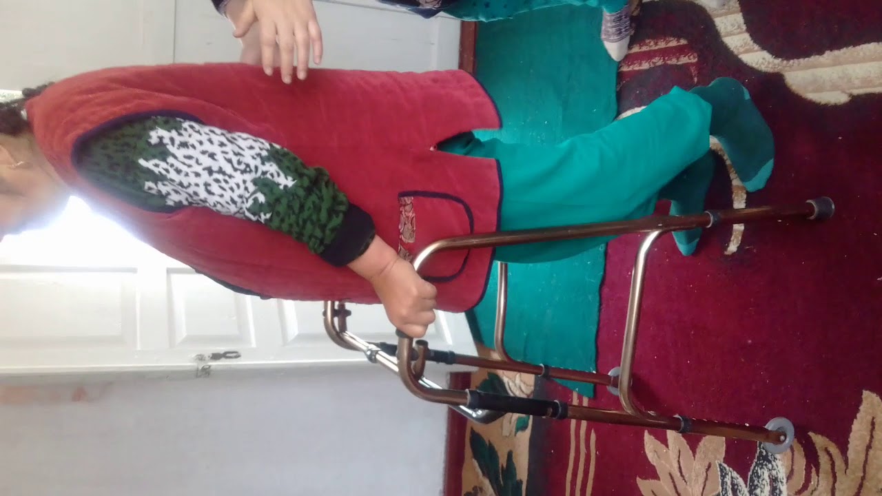 ХВДП через год после лечение - YouTube