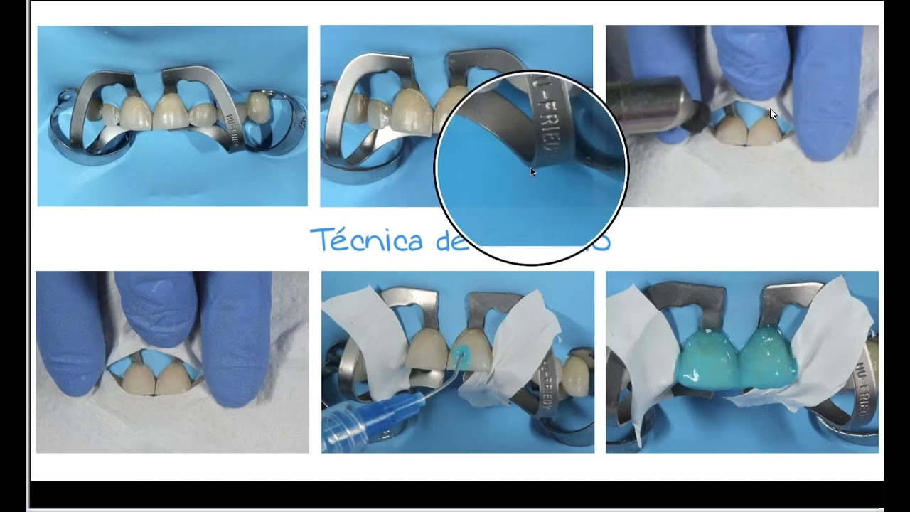 3m Universal Monica Gonzalez