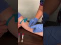 Missed twice… heart racing, hands shaking 😬 But you're a pro! #phlebotomy #phlebotomist #lablife