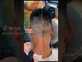 Incredible Scalp Micropigmentation Result! | Plastic Surgeon Reacts