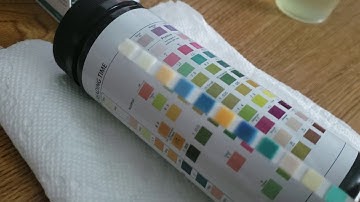 How To Read Urine Test Strips