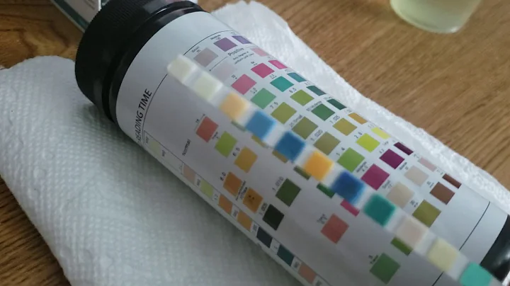 How To Read Urine Test Strips