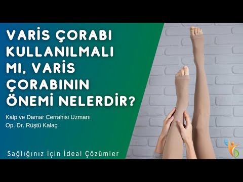 Varis Çorabı Kullanılmalı mı, Varis Çorabının Önemi Nelerdir?