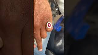 Famous Ruby Ring 💍 #jewellery #shortvideo Wealth